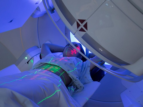  Radiation Therapy